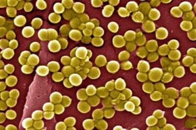 Бактерии стафилококка золотистого