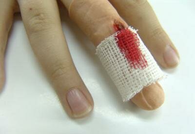 Первая помощь при лечении травм на пальцах
